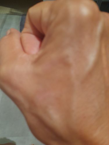 Customer photo review of Healing Balm (30ml)
