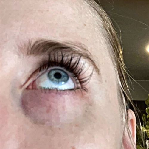 Customer photo review of SHOW LASH