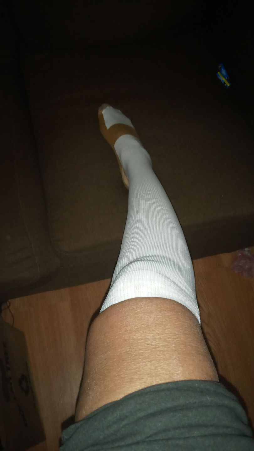 Customer photo review of Copper Compression Socks (3-Pack)