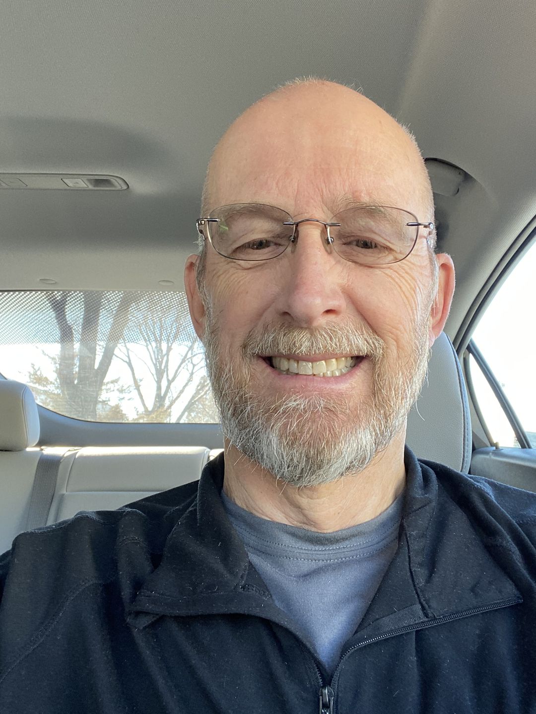 Customer photo review of SHINE Premium Beard Cream (2 oz)