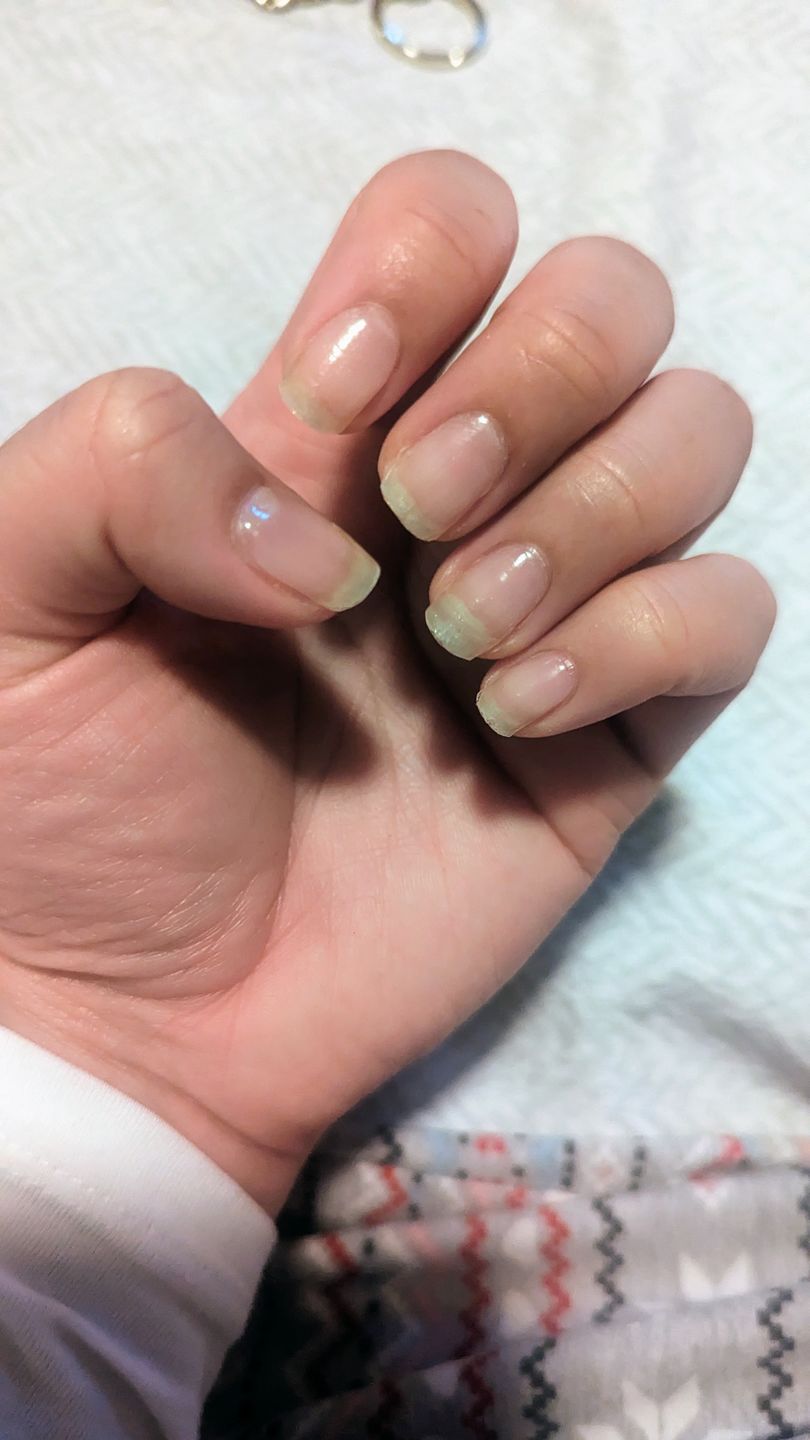 Customer photo review of Crystal Clear DIY Semicured Gel Nail Sticker Kit (PREORDER)