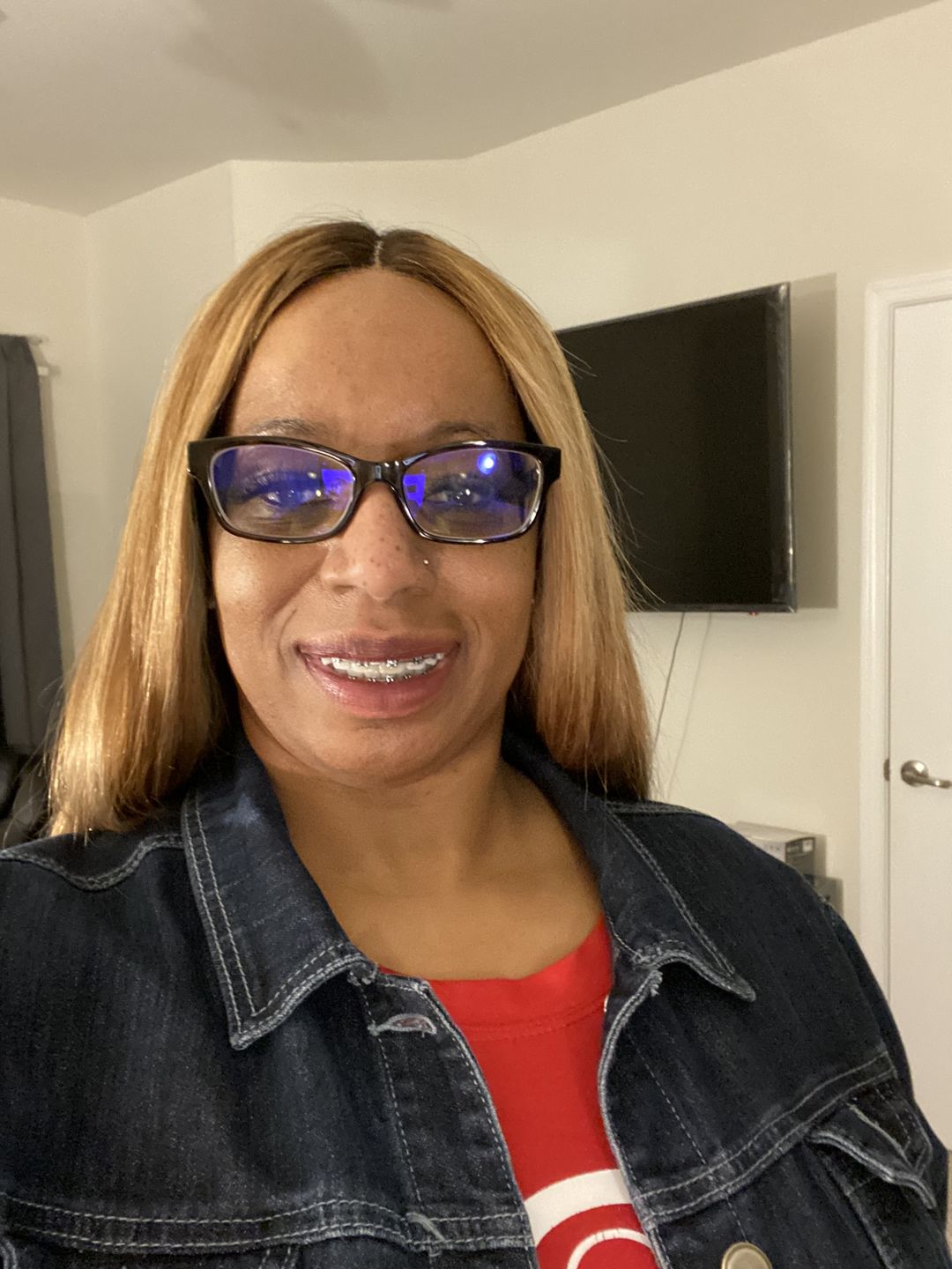 Customer photo review of A-Dream Brightening Eye Cream