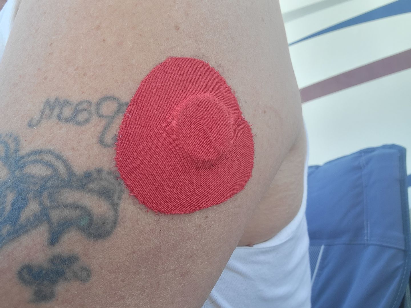 Customer photo review of Skin Grip Original - Freestyle Libre Adhesive Patches