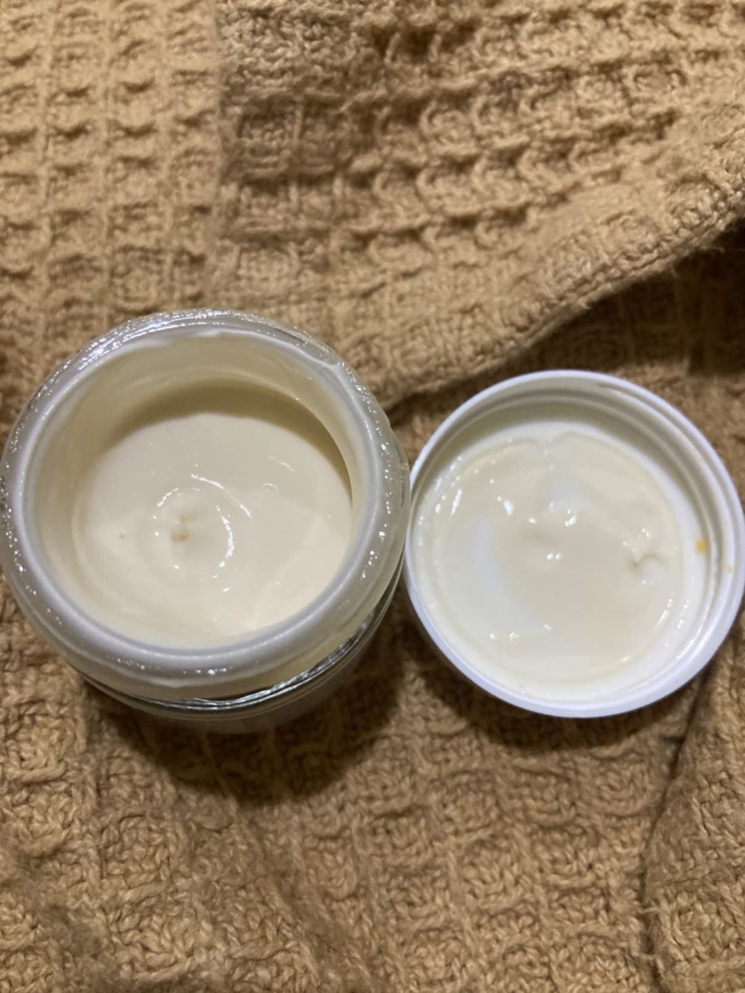 Customer photo review of Miracle Kelp Eye Cream