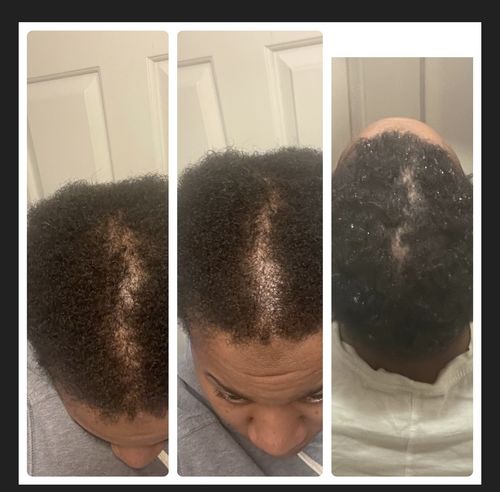 Customer photo review of Growth Bundle