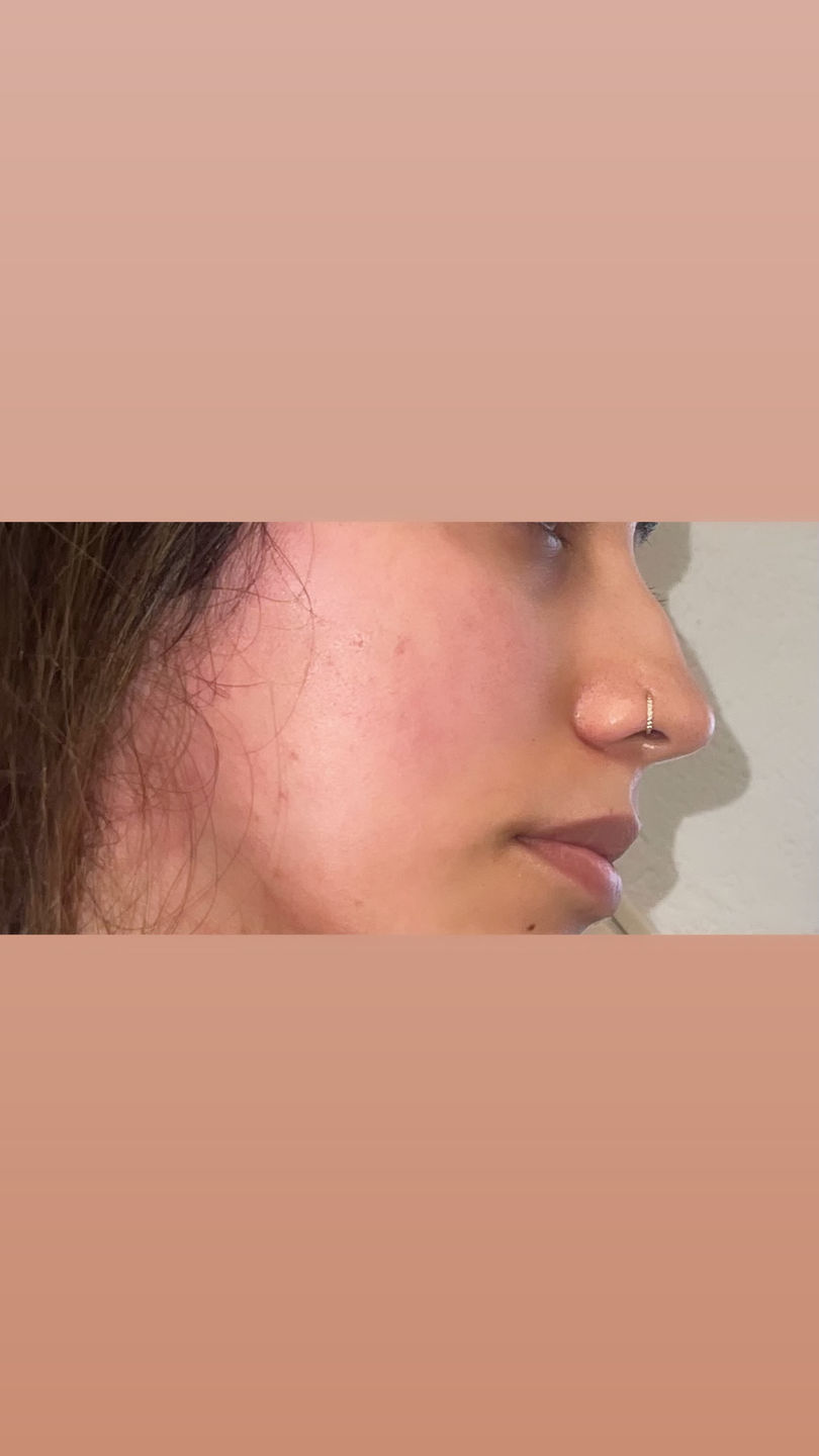 Customer photo review of Zircon Clicker | Nasen- & Ohrpiercing