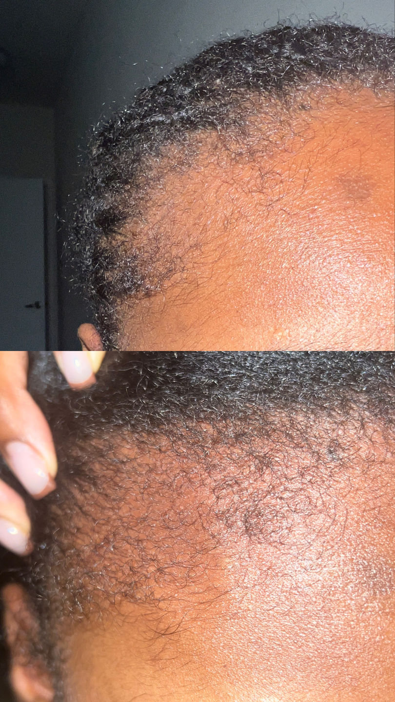 Customer photo review of Hair Growth Oil