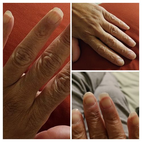 Customer photo review of Rocket Nail Fuel Nail Repair - Clear