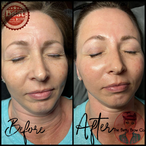 Customer photo review of Scalpa Plant Cell Serum With FREE Training