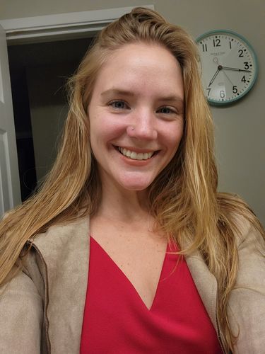 Customer photo review of Skinceuticals Daily Moisture, 60mL 2 OZ