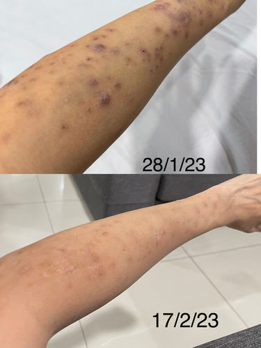 Customer photo review of Jolicare™ Family Set