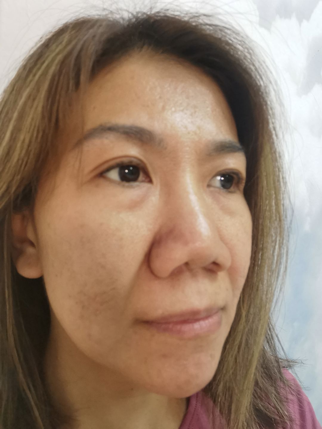 Customer photo review of CLEF CNY Bundle - Peptide Mask + Essence