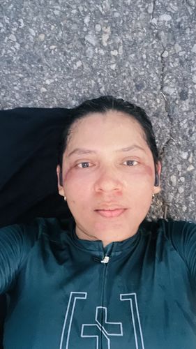 Customer photo review of KIT SERUM FACIAL DIA Y SERUM FACIAL NOCHE CON  CELULAS MADRE VEGETALES