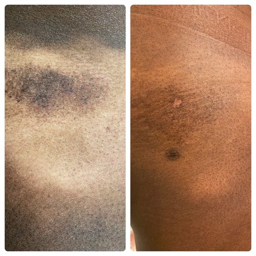 Customer photo review of African Black Soap