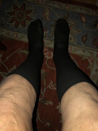 Customer photo review of Copper Compression Socks (3-Pack)