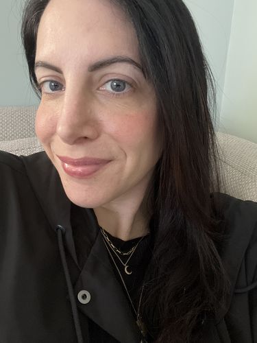 Customer photo review of CheekFix: Filler