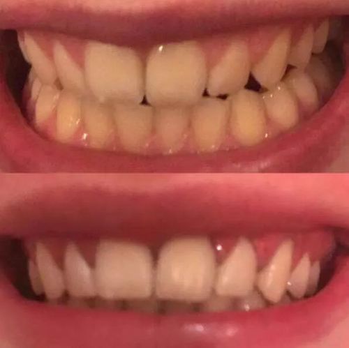 Customer photo review of Farbkorrektur - Serum