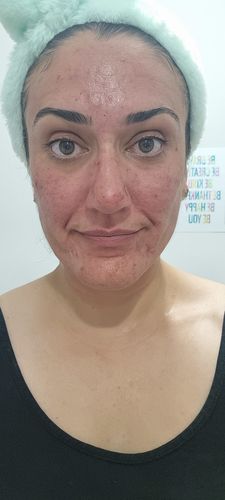 Customer photo review of Dr. Pen M8