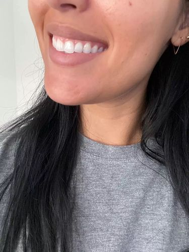 Customer photo review of Farbkorrektur - Serum