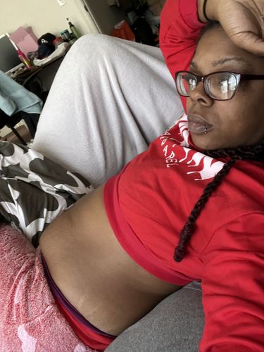 Customer photo review of GML-Apeti (20 Tablets)