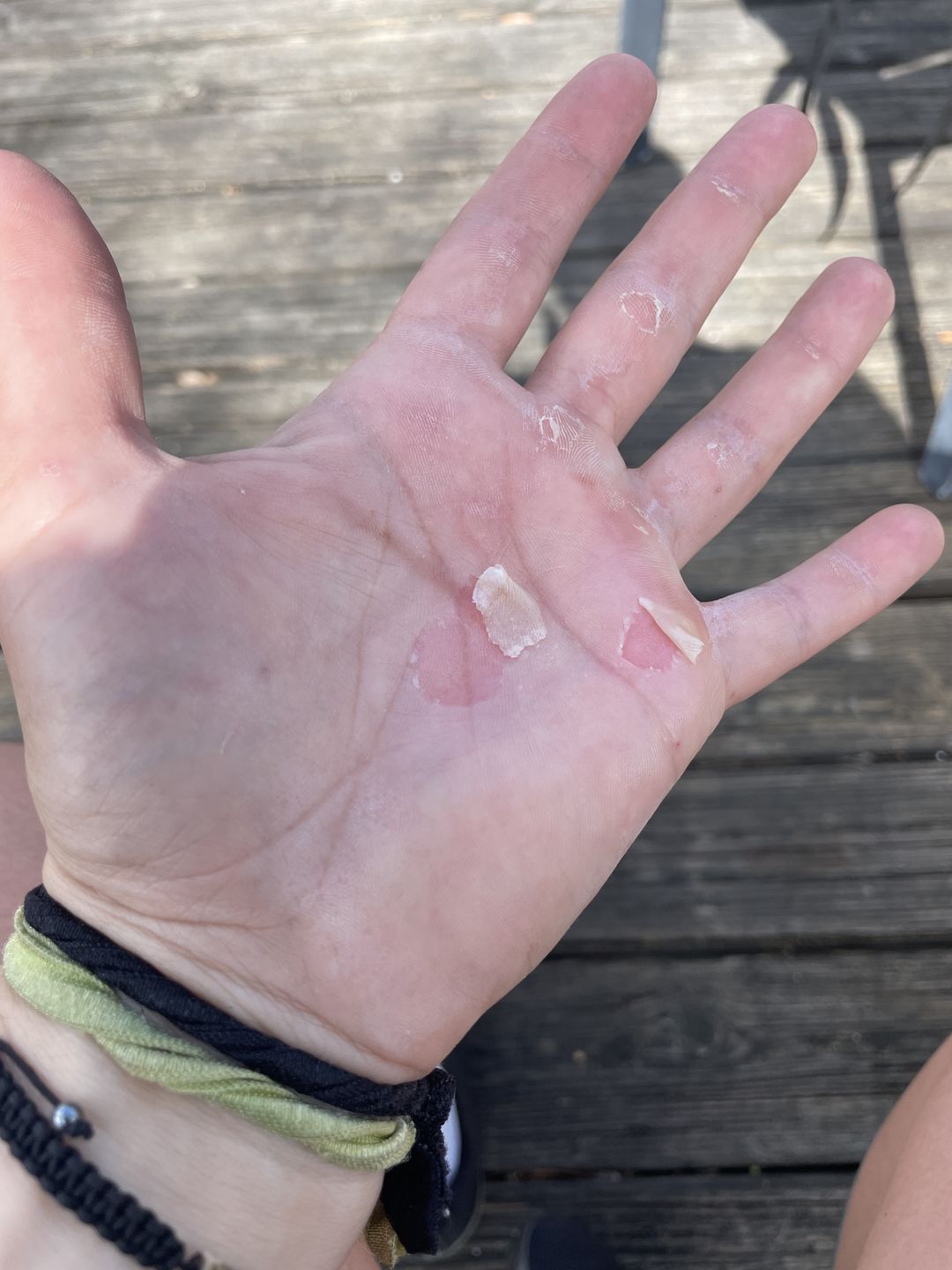 Customer photo review of Combat Ready Ointment - Triple Threat