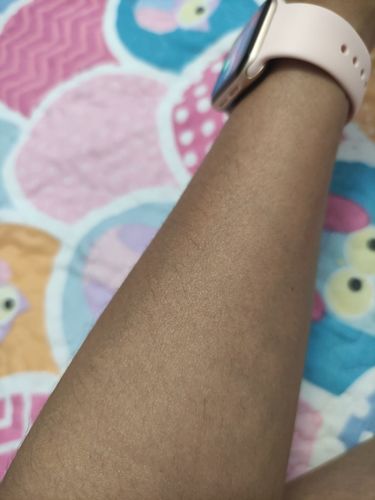 Customer photo review of Depilador Nuva Skin®