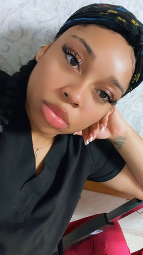 Customer photo review of FRESH FACE PACKAGE (Cleanser x Toner x Serum)