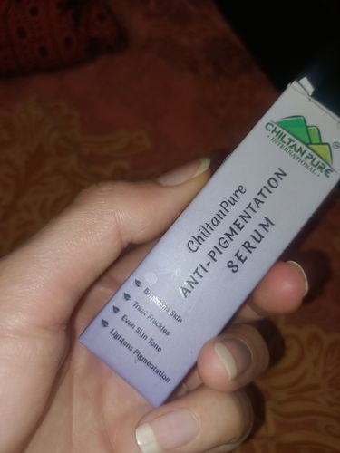 Customer photo review of Anti-Pigmentation Serum – Brighten Skin, Lighten Pigmentation, Fade Freckles & Even Skin Tone 30ml