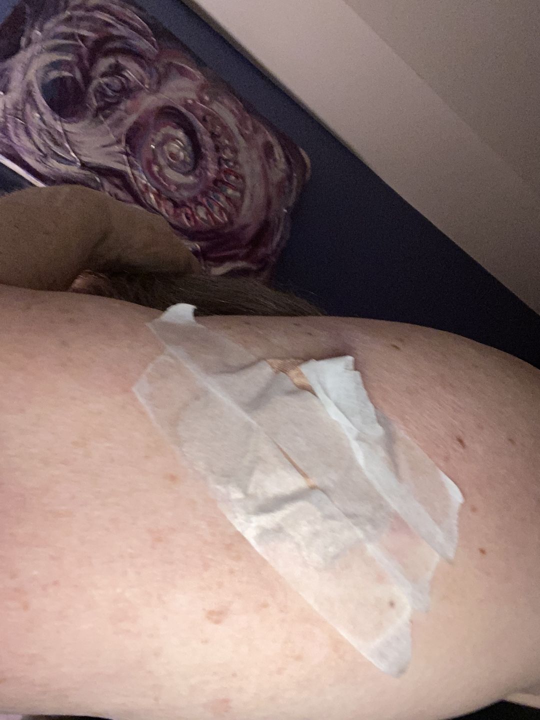 Customer photo review of Skin Grip Original - Freestyle Libre Adhesive Patches