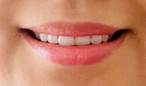 Customer photo review of JuicyPop™ Instantly Plump Lip Balm