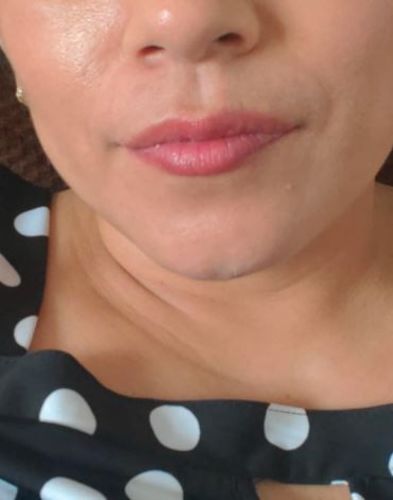 Customer photo review of JuicyPop™ Instantly Plump Lip Balm