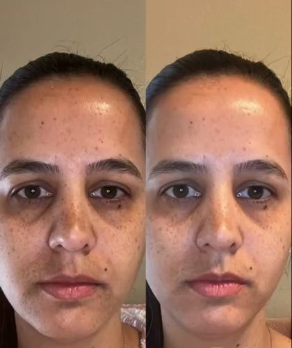 Customer photo review of 🔥Limited Time Discount 🔥 Last Day🔥OPENEYES Awaken Peptide Lifting Eye Gel