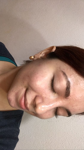 Customer photo review of PM Facial Moisturizing Lotion