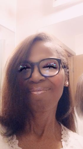 Customer photo review of Alopecia Growth Serum