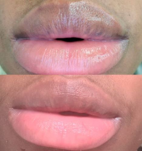 Customer photo review of JuicyPop™ Instantly Plump Lip Balm