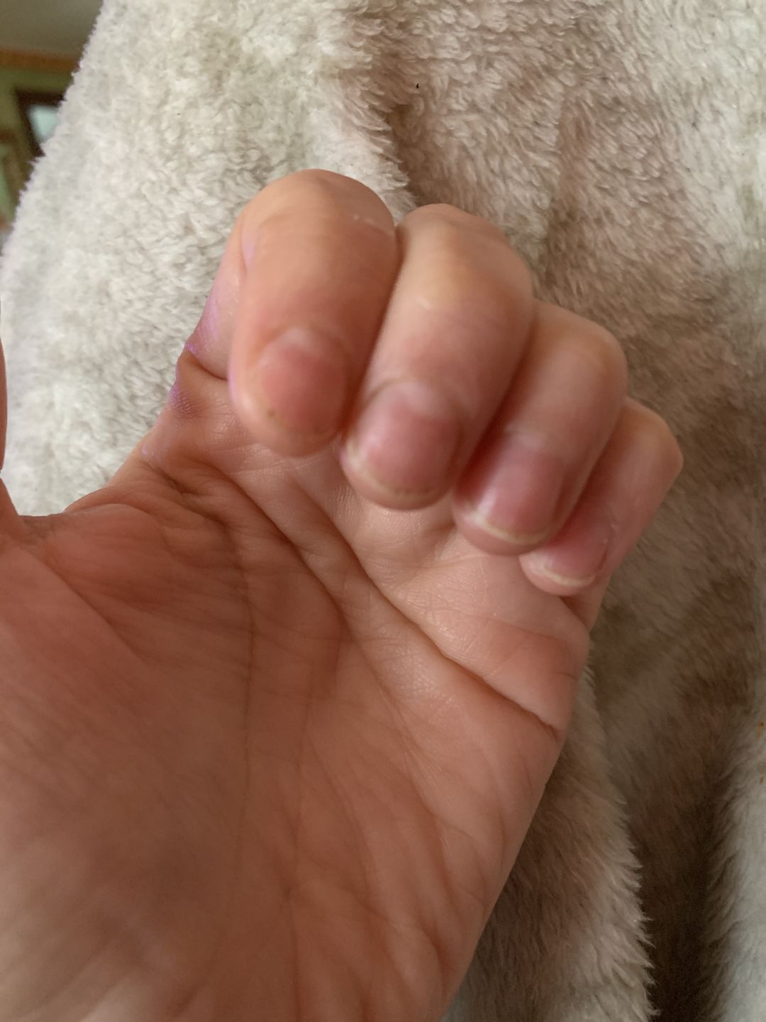 Customer photo review of Cuticle Remover 30 ml LCI