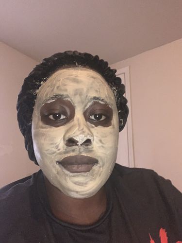 Customer photo review of DELUXE PACKAGE (Scrub x Mask x Serum)