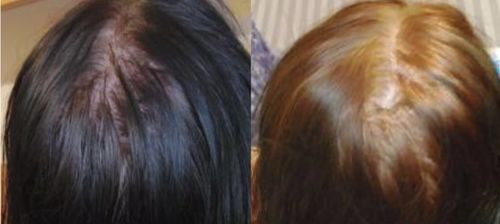 Customer photo review of Growth & Shine Hair Oil