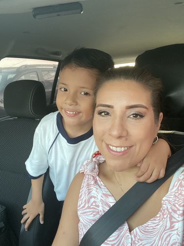 Customer photo review of KIT SUEROS FACIALES DÍA Y NOCHE CON CÉLULAS MADRE, COLÁGENO Y ÁCIDO HIALURÓNICO.