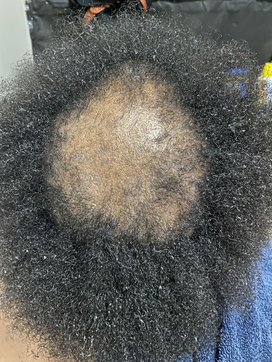 Customer photo review of Healthy Hair & Lashes bundle