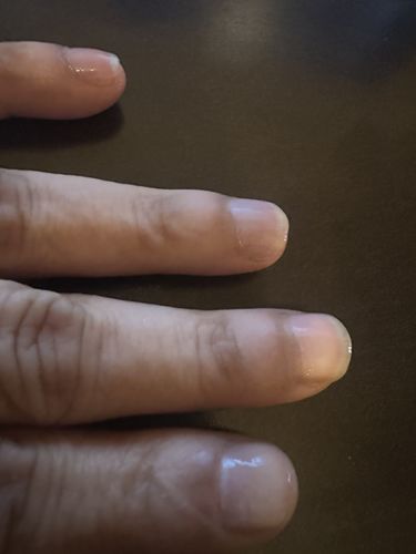 Customer photo review of Rocket Nail Fuel Starter Kit