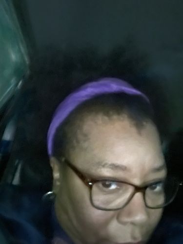 Customer photo review of India’s Secret Ancient Ayurvedic Hair Follicle Elixir (4 sizes)