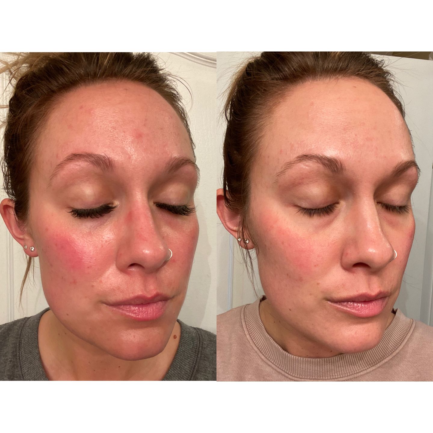 Customer photo review of Facial Care System