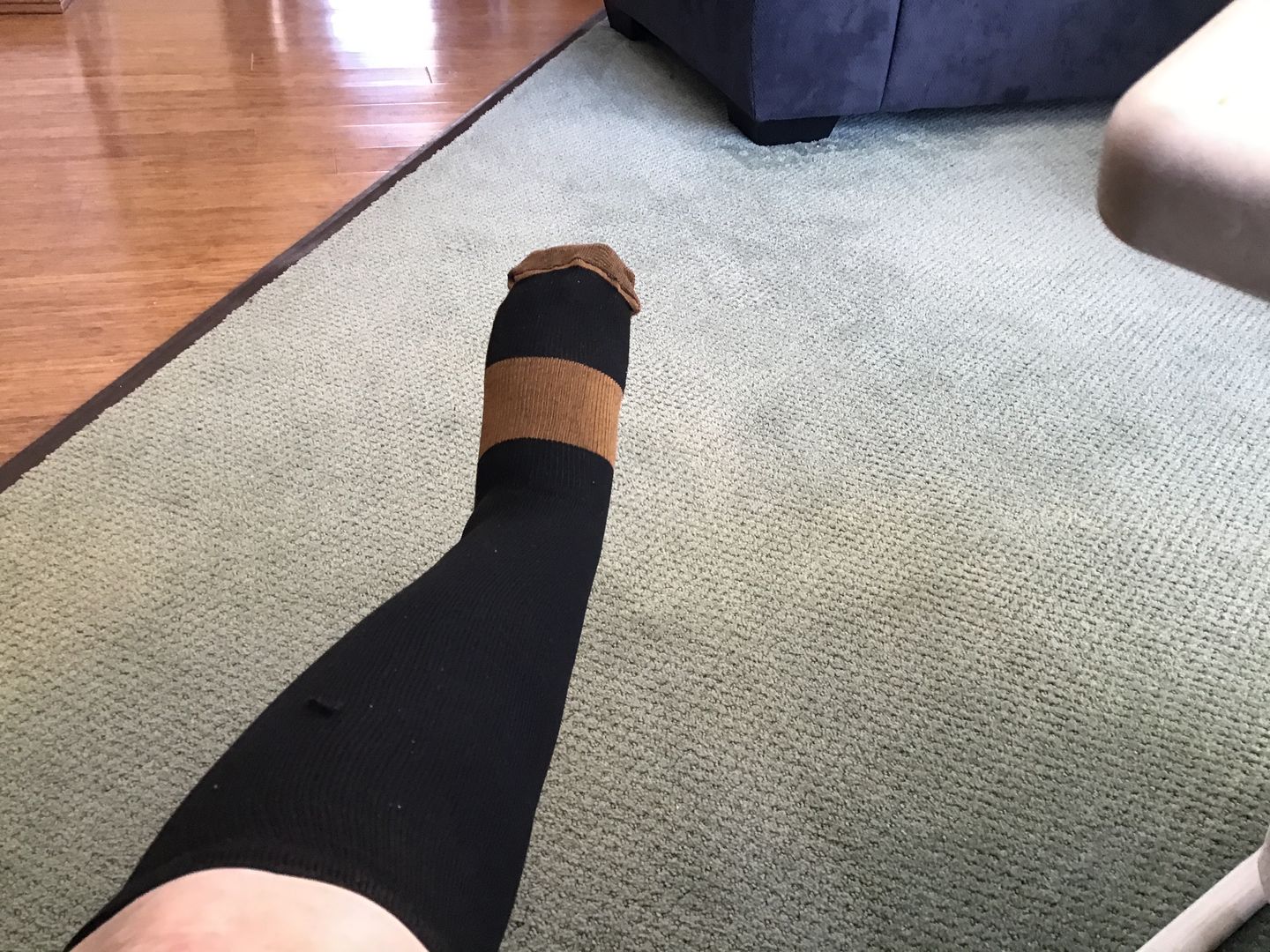 Customer photo review of Copper Compression Socks (3-Pack)