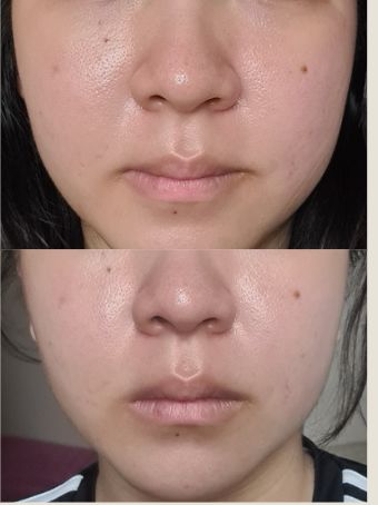 Customer photo review of CLEF Ocean Elixir Multi-Algae Hydrating Toner (120ml)