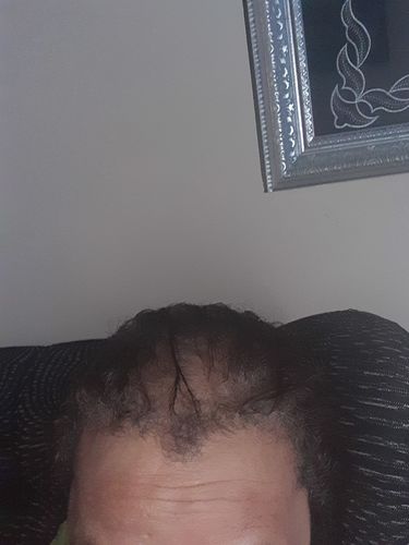 Customer photo review of Hair & Nail Herbs Tincture - Buy 1 Get 1 Free Offer