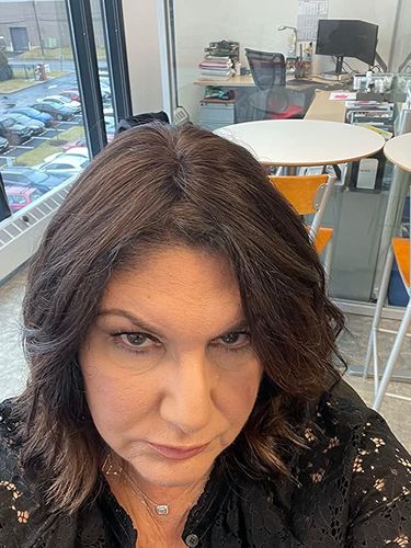 Customer photo review of Moresoo Topper Remy Real Human Hair Pieces Dark Brown(#2)