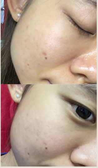 Customer photo review of CLEF Ocean Elixir Multi-Algae Hydrating Cleanser (150ml)