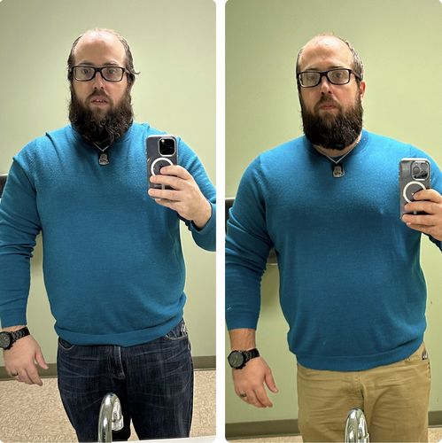 Customer photo review of Hydroxygenin™ - Hormonal Fat Burner, Muscle Preserving Blend