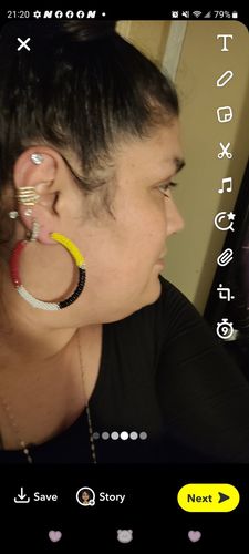 Customer photo review of KonixPLUS DiamondCut LymphDetox Magnetherapy Earrings（Limited Time Discount 🔥 Last Day）